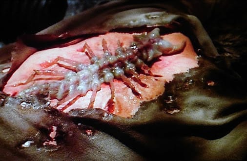 B5 Rewatch: 3×07 "Exogenesis"